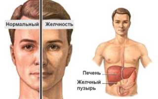 Прием урсосана при синдроме жильбера