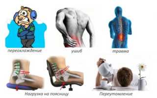 Вертеброгенная люмбалгия с миофасциальным синдромом
