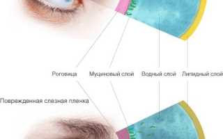 Синдром сухого глаза лечение медикаментозное