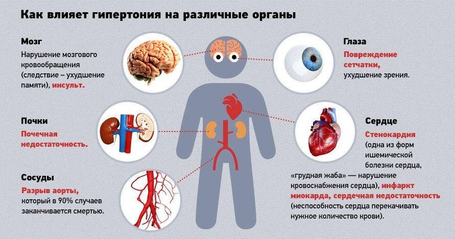 Синдром вертебральной артерии по мкб 10