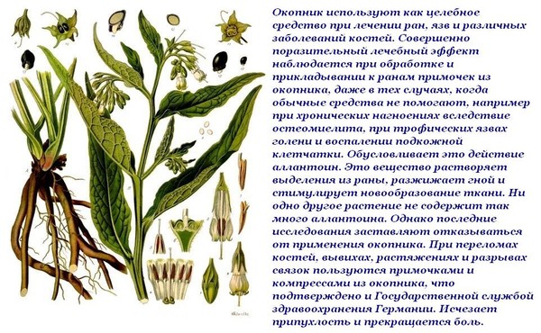 Лечение синдрома грушевидной мышцы мазями
