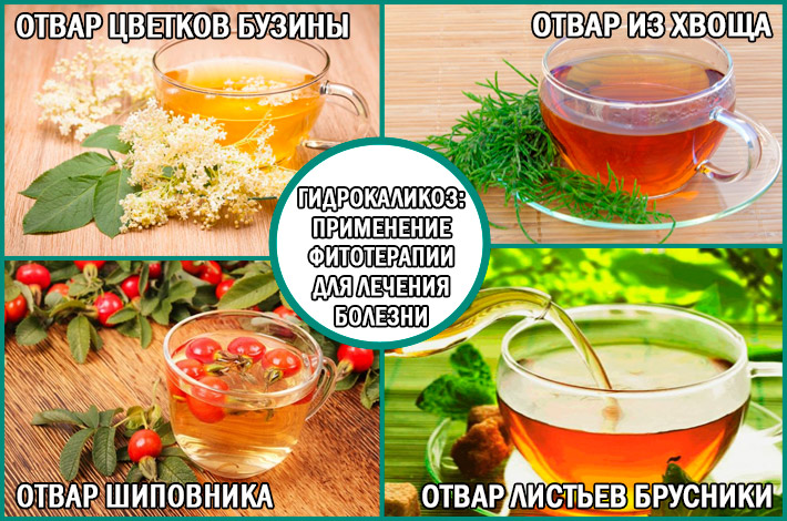Применение фитотерапии для лечения гидрокаликоза