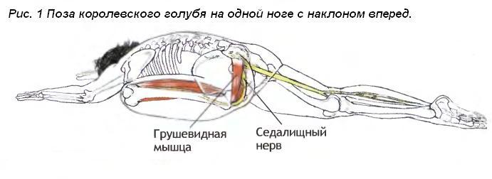 Лечение синдрома грушевидной мышцы мазями