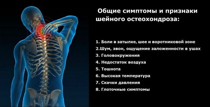 Стандарт лечения остеохондроза позвоночника с корешковым синдромом