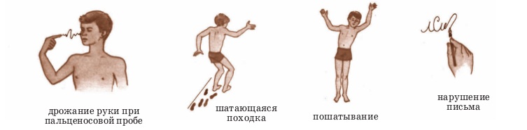  признаки атаксии