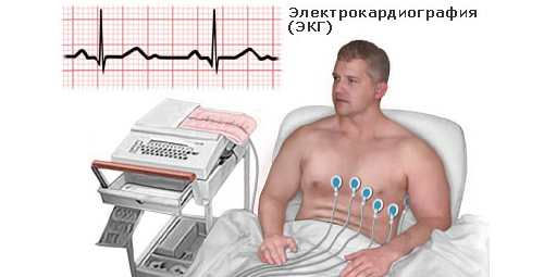 Электрокардиография