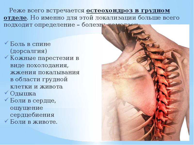 Стандарт лечения остеохондроза позвоночника с корешковым синдромом