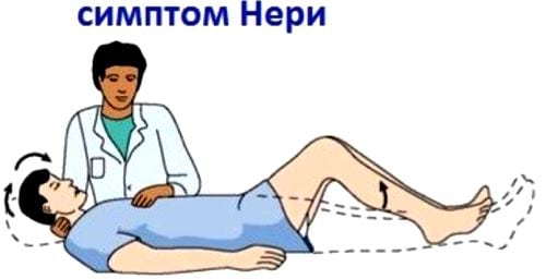 Стандарт лечения остеохондроза позвоночника с корешковым синдромом