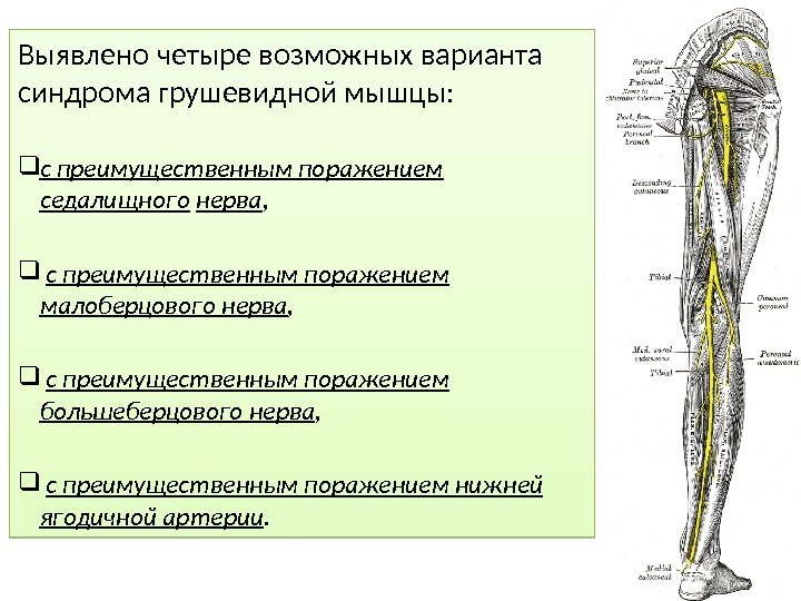 Лечение синдрома грушевидной мышцы мазями